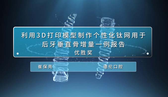 利用3D打印模型制作个性化钛网用于后牙垂直骨增量一例报告
