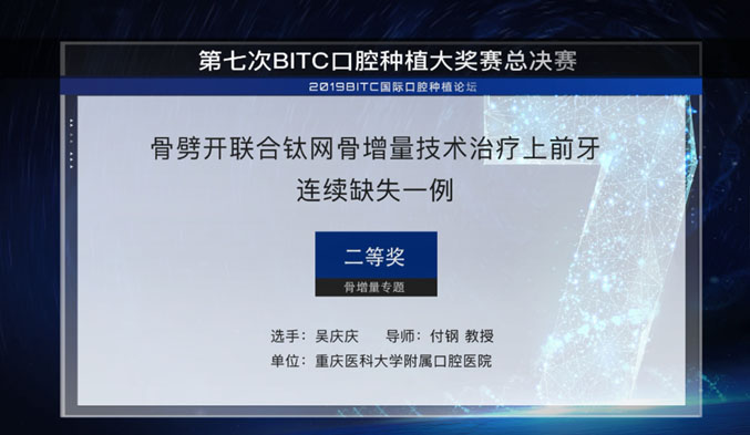 骨劈开联合钛网骨增量技术治疗上前牙连续缺失一例