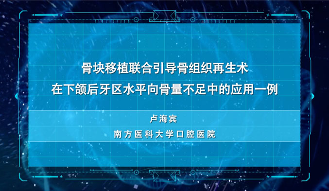 骨块移植联合引导骨组织再生术在下颌后牙区水平向骨量不足的应用1例