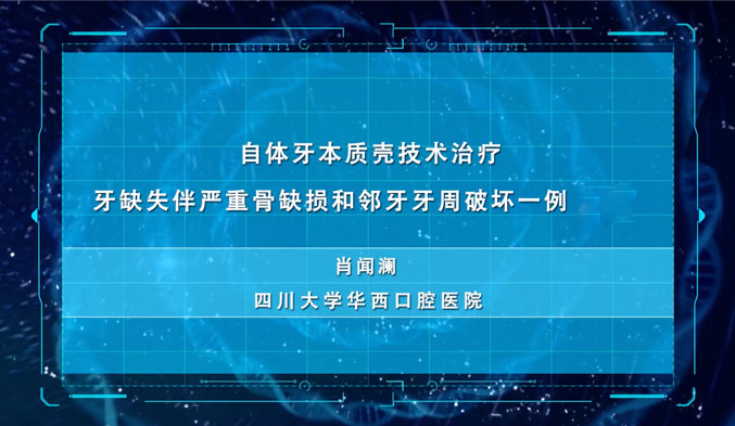 自体牙本质壳技术治疗牙缺失伴严重骨缺损和邻牙牙周破坏一例