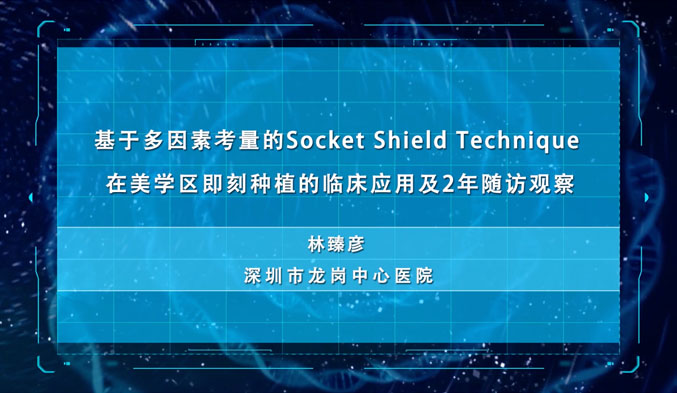 基于多因素考量的Socket Shield Technique在美学区即刻种植的临床应用及2年随访观察