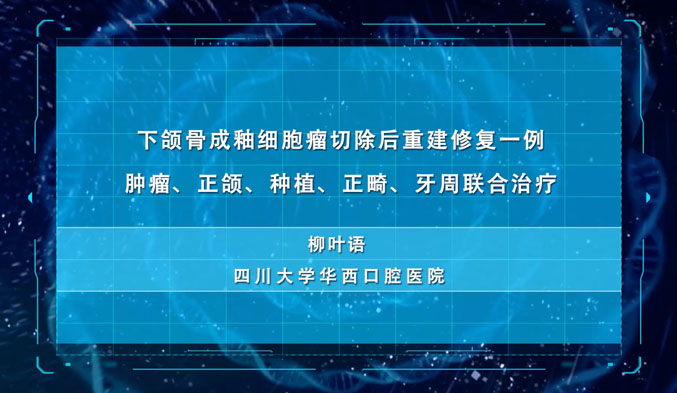 下颌骨成釉细胞瘤切除后重建修复一例：肿瘤、正颌、种植、正畸、牙周联合治疗