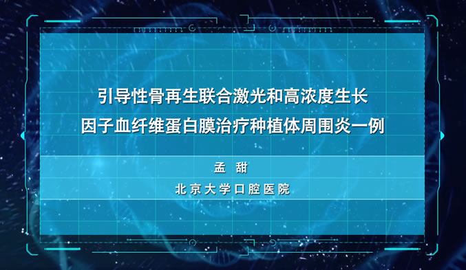 引导性骨再生联合激光和高浓度生长因子血纤维蛋白膜治疗种植体周围炎一例