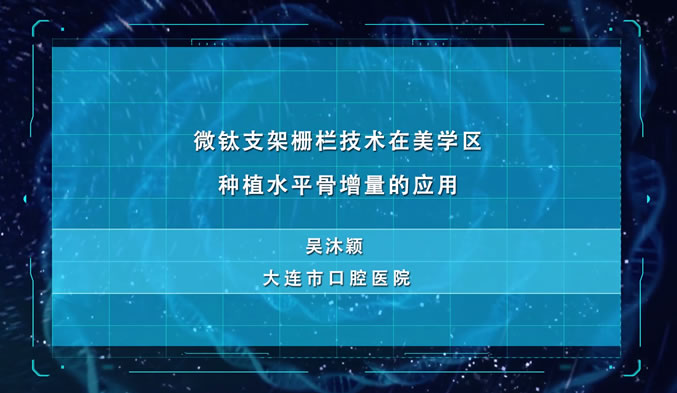 微钛支架栅栏技术在美学区种植水平骨增量的应用