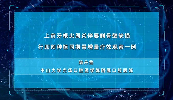 上前牙根尖周炎伴唇侧骨壁缺损行即刻种植同期骨增量疗效观察一例