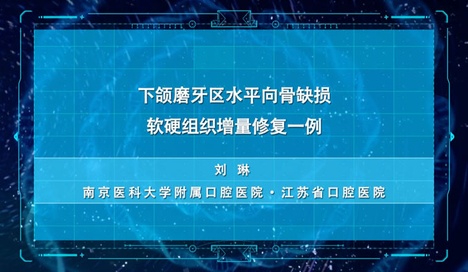 下颌磨牙区水平向骨缺损软硬组织增量修复一例