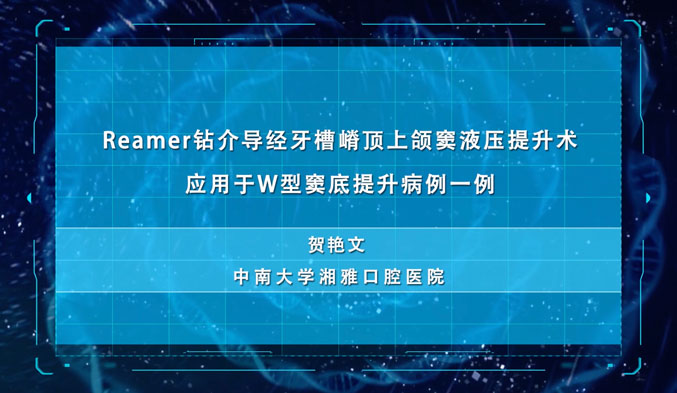 Reamer钻介导经牙槽嵴顶上颌窦液压提升术应用于W型窦底提升病例一例