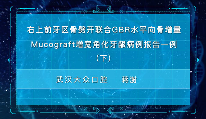 右上前牙区骨劈开联合GBR水平向骨增量Mucograft增宽角化牙龈病例报告一例（下）