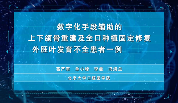 数字化手段辅助的上下颌骨重建及全口种植固定修复外胚叶发育不全患者一例