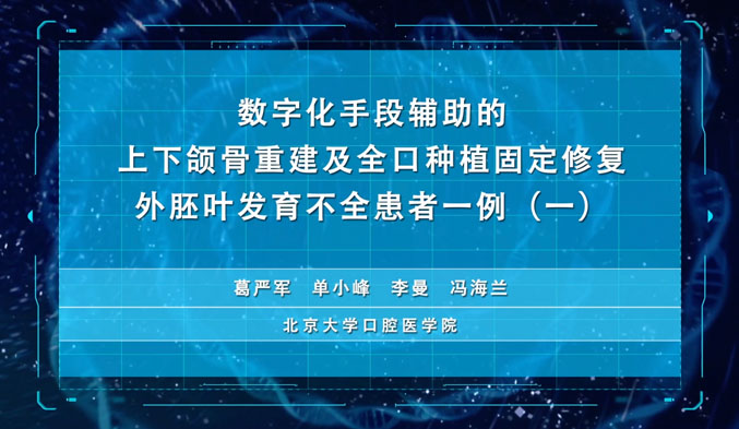 数字化手段辅助的上下颌骨重建及全口种植固定修复外胚叶发育不全患者一例（一）