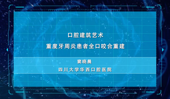 口腔建筑艺术——重度牙周炎患者全口咬合重建