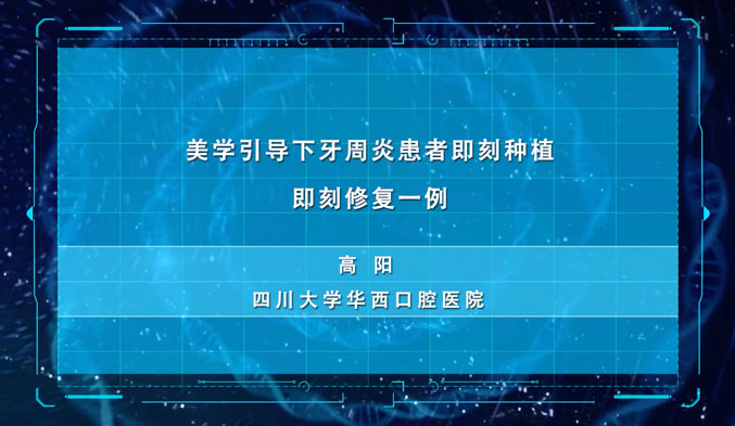 美学引导下牙周炎患者即刻种植即刻修复一例