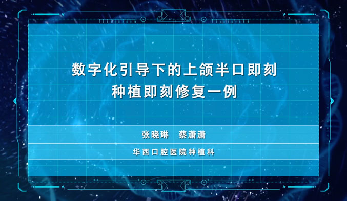 数字化引导下的上颌半口即刻种植即刻修复一例