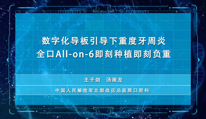 数字化导板引导下重度牙周炎全口All-on-6即刻种植即刻负重