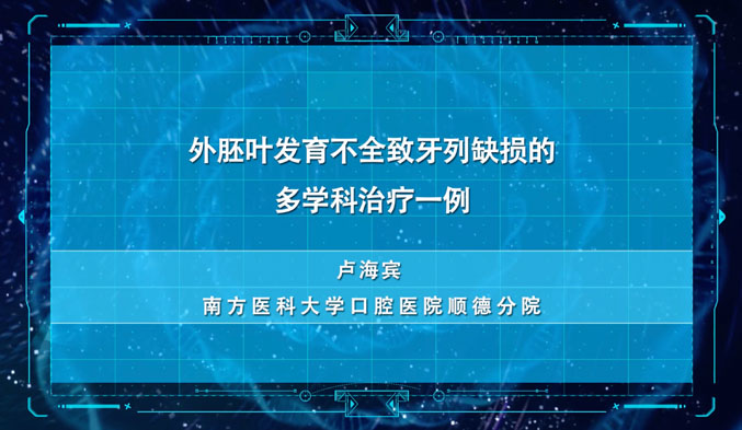 外胚叶发育不全致牙列缺损的多学科治疗一例