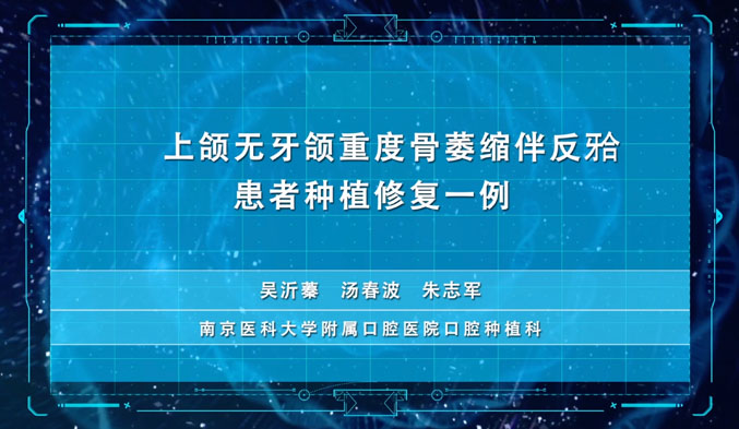 上颌无牙颌重度骨萎缩伴反𬌗患者种植修复一例