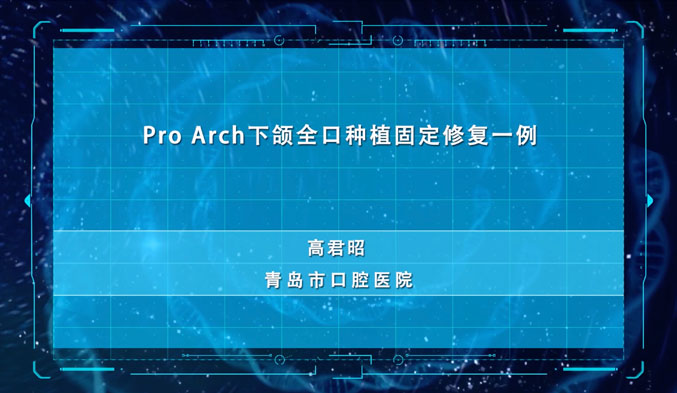 Pro Arch下颌全口种植固定修复一例