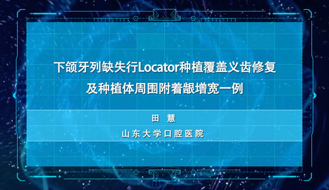 下颌牙列缺失行Locator种植覆盖义齿修复及种植体周围附着龈增宽一例