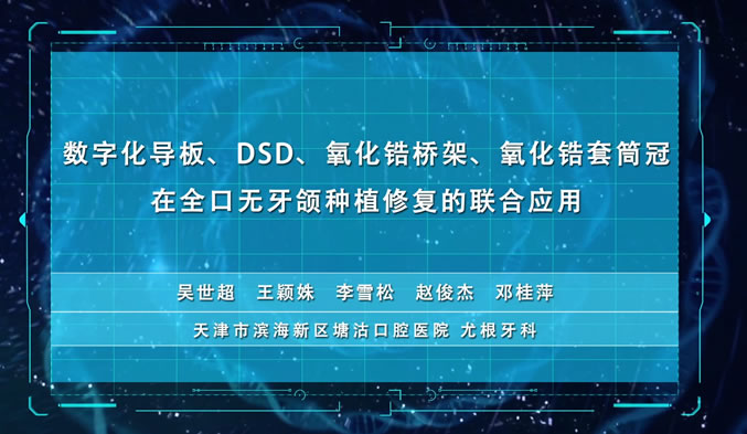 数字化导板、DSD、氧化锆桥架、氧化锆套筒冠在全口无牙颌种植修复的联合应用