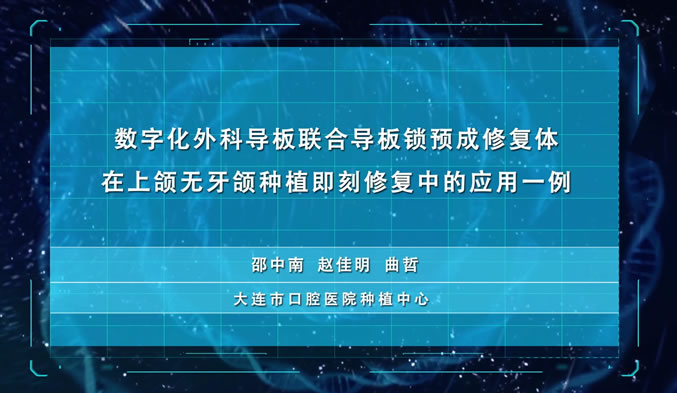 数字化外科导板联合导板锁预成修复体在上颌无牙颌种植即刻修复中的应用一例