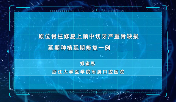 原位骨柱修复上颌中切牙严重骨缺损延期种植延期修复一例