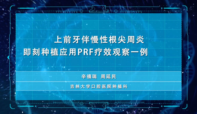 上前牙伴慢性根尖周炎即刻种植应用PRF疗效观察一例