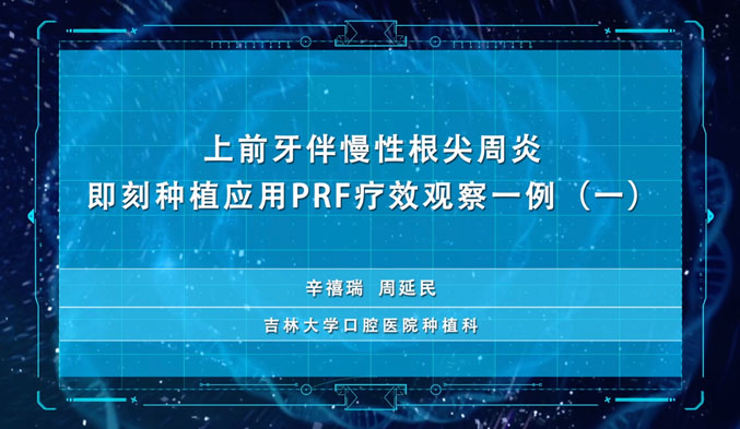 上前牙伴慢性根尖周炎即刻种植应用PRF疗效观察一例（一）