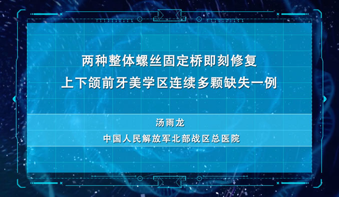 两种整体螺丝固定桥即刻修复上下颌前牙美学区连续多颗缺失一例