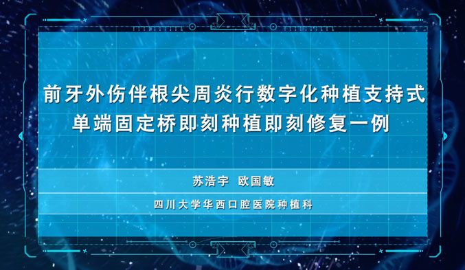 前牙外伤伴根尖周炎行数字化种植支持式单端固定桥即刻种植即刻修复一例