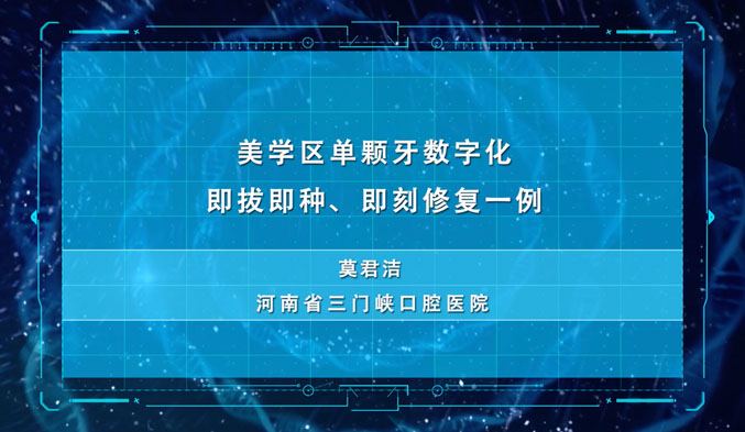 美学区单颗牙数字化即拔即种、即刻修复一例