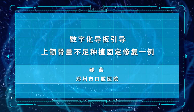 数字化导板引导上颌骨量不足种植固定修复一例