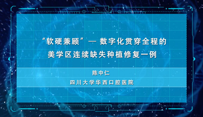 “软硬兼施”——数字化贯穿全程的美学区连续缺失种植修复一例