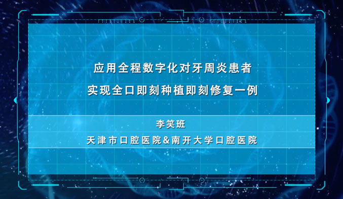 应用全程数字化对牙周炎患者实现全口即刻种植即刻修复一例