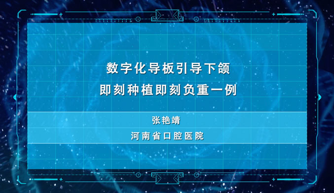 数字化导板引导下颌即刻种植即刻负重一例