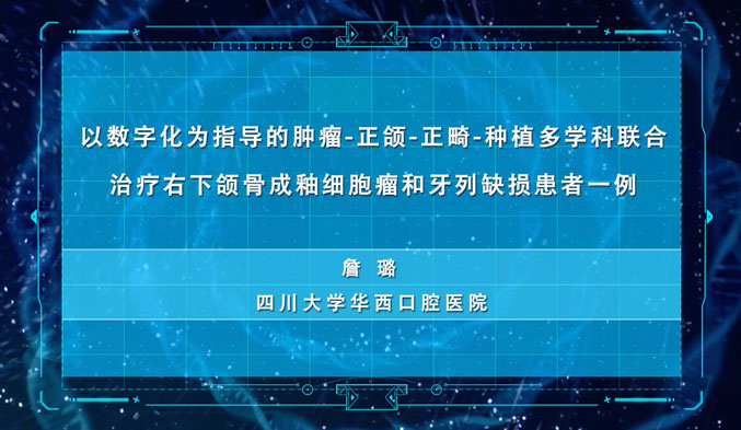 以数字化为指导的肿瘤-正颌-正畸-种植多学科联合治疗右下颌骨成釉细胞瘤和牙列缺损患者一例