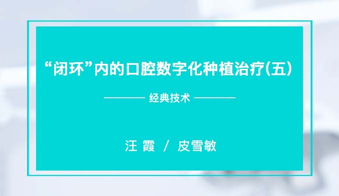 “闭环”内的口腔数字化种植治疗（五）