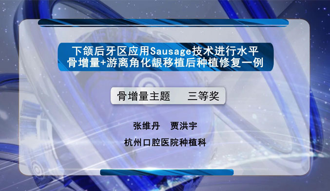 下颌后牙区应用Sausage技术进行水平骨增量+游离角化龈移植后种植修复一例