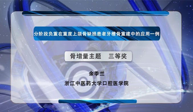 分阶段负重在重度上颌骨缺损患者牙槽骨重建中的应用一例