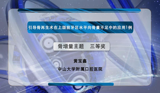 引导骨再生术在上颌前牙区水平向骨量不足中的应用1例