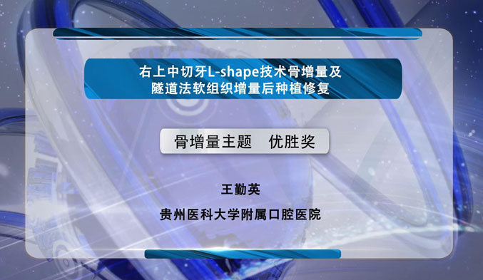 右上中切牙L-shape技术骨增量及隧道法软组织增量后种植修复