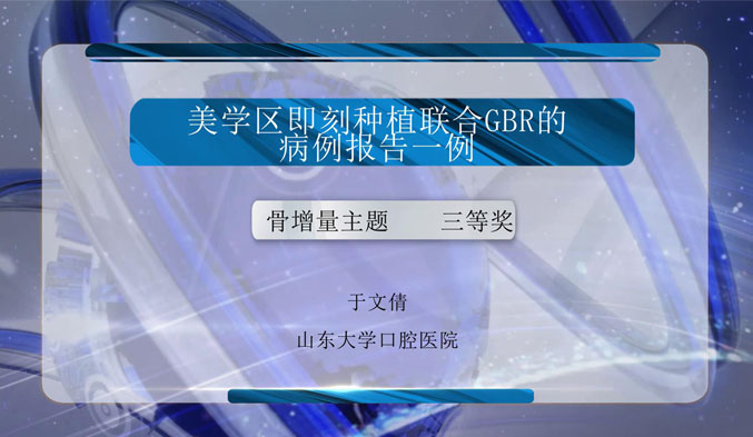 美学区即刻种植联合GBR的病例报告一例