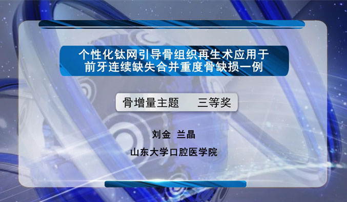 个性化钛网引导骨组织再生术应用于前牙连续缺失合并重度骨缺损一例