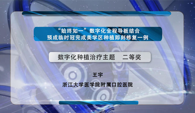 “始终如一”数字化全程导板结合预成临时冠完成美学区种植即刻修复一例