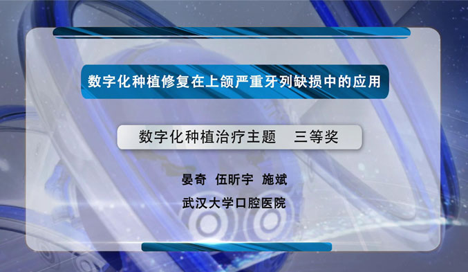 数字化种植修复在上颌严重牙列缺损中的应用