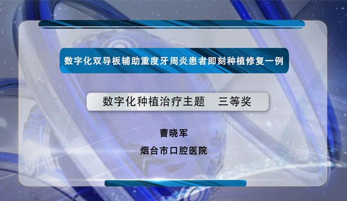 数字化双导板辅助重度牙周炎患者即刻种植修复一例