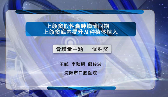 上颌窦假性囊肿摘除同期上颌窦底内提升及种植体植入