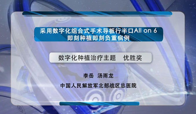 采用数字化组合式手术导板行半口All on 6即刻种植即刻负重病例