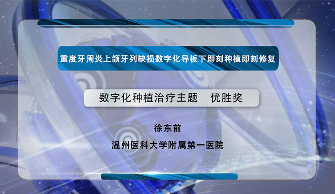 重度牙周炎上颌牙列缺损数字化导板下即刻种植即刻修复