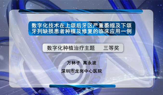 数字化技术在上颌后牙区严重萎缩及下颌牙列缺损患者种植及修复的临床应用一例