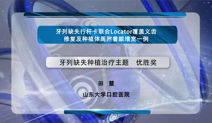 牙列缺失行杆卡联合Locator覆盖义齿修复及种植体周附着龈增宽一例